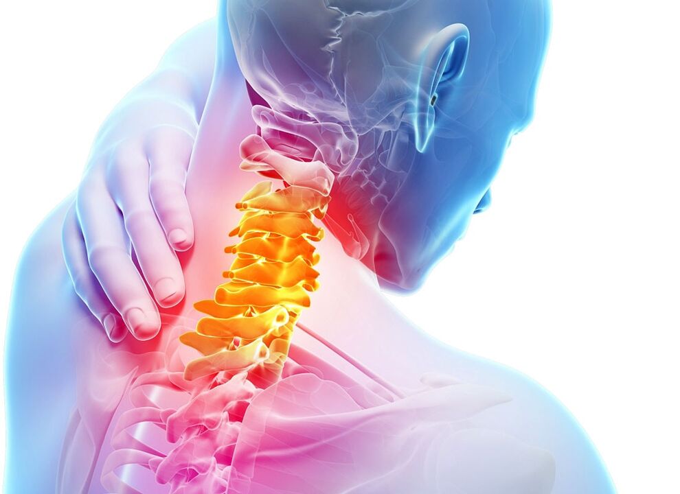 a nyaki osteochondrosis tünetei